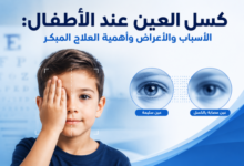 كسل العين عند الأطفال